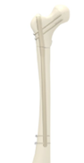 A white object with a metal handle

AI-generated content may be incorrect.